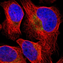 Invitrogen CD273 (B7-DC) Polyclonal Antibody 100 &mu;L; Unconjugated:Antibodies,