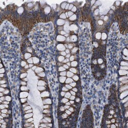 Invitrogen CD273 (B7-DC) Polyclonal Antibody 100 &mu;L; Unconjugated:Antibodies,