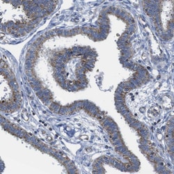 Invitrogen CD273 (B7-DC) Polyclonal Antibody 100 &mu;L; Unconjugated:Antibodies,