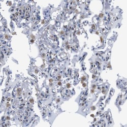 Invitrogen CD273 (B7-DC) Polyclonal Antibody 100 &mu;L; Unconjugated:Antibodies,
