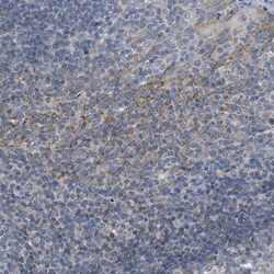 Invitrogen CD273 (B7-DC) Polyclonal Antibody 100 &mu;L; Unconjugated:Antibodies,