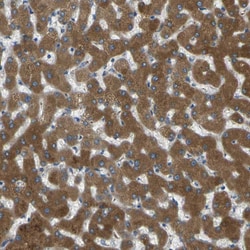 Invitrogen CYP2C8 Polyclonal Antibody 100 &mu;L; Unconjugated:Antibodies,