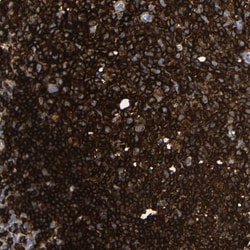 Invitrogen HLA-DQB1 Polyclonal Antibody 100 &mu;L; Unconjugated:Antibodies,