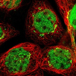 Invitrogen SLITRK5 Polyclonal Antibody 100 &mu;L; Unconjugated:Antibodies,