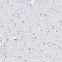 Invitrogen CD223 Polyclonal Antibody 100 &mu;L; Unconjugated:Antibodies,
