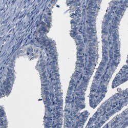 Invitrogen CYP2C8 Polyclonal Antibody 100 &mu;L | Buy Online | Invitrogen&trade; | Fisher Scientific
