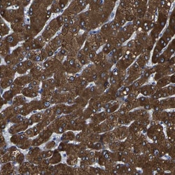 Invitrogen CYP2C8 Polyclonal Antibody 100 &mu;L | Buy Online | Invitrogen&trade; | Fisher Scientific