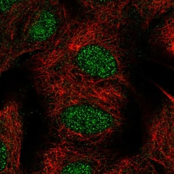 Invitrogen TYW1B Polyclonal Antibody 100 &mu;L; Unconjugated:Antibodies,