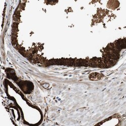 Invitrogen Latexin Polyclonal Antibody 100 &mu;L; Unconjugated:Anticuerpos