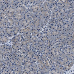 Invitrogen TOM70 Polyclonal Antibody 100 &mu;L; Unconjugated:Antibodies,