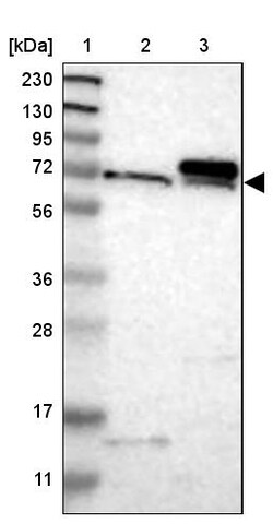 Invitrogen TOM70 Polyclonal Antibody 100 &mu;L; Unconjugated:Antibodies,