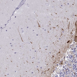 Invitrogen NEFL Polyclonal Antibody 100 &mu;L; Unconjugated:Antibodies,