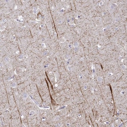 Invitrogen NEFL Polyclonal Antibody 100 &mu;L; Unconjugated:Antibodies,