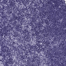 Invitrogen NEFL Polyclonal Antibody 100 &mu;L; Unconjugated:Antibodies,