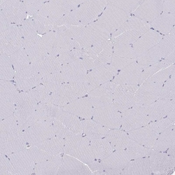 Invitrogen NEFL Polyclonal Antibody 100 &mu;L; Unconjugated:Antibodies,
