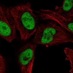 Invitrogen PTPN2 Polyclonal Antibody 100 &mu;L; Unconjugated:Antibodies,