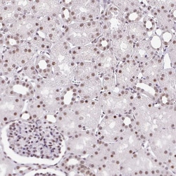 Invitrogen PTPN2 Polyclonal Antibody 100 &mu;L; Unconjugated:Antibodies,