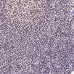 Invitrogen PTPN2 Polyclonal Antibody 100 &mu;L; Unconjugated:Antibodies,