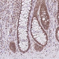 Invitrogen PTPN2 Polyclonal Antibody 100 &mu;L; Unconjugated:Antibodies,