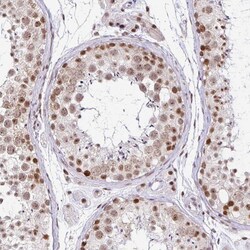 Invitrogen PTPN2 Polyclonal Antibody 100 &mu;L; Unconjugated:Antibodies,