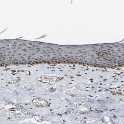 Invitrogen ORAI3 Polyclonal Antibody 100 &mu;L; Unconjugated:Antibodies,