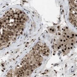 Invitrogen ORAI3 Polyclonal Antibody 100 &mu;L; Unconjugated:Antibodies,