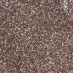 Invitrogen BRD4 Polyclonal Antibody 100 &mu;L | Buy Online | Invitrogen&trade; | Fisher Scientific