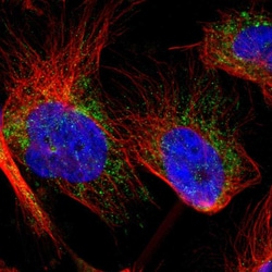 Invitrogen SLC25A31 Polyclonal Antibody 100 &mu;L; Unconjugated:Antibodies,