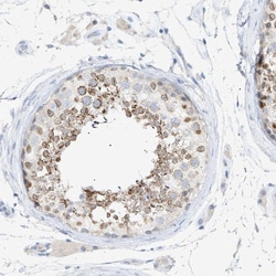 Invitrogen SLC25A31 Polyclonal Antibody 100 &mu;L; Unconjugated:Antibodies,