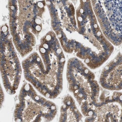 Invitrogen SLC30A1 Polyclonal Antibody 100 &mu;L; Unconjugated:Antibodies,