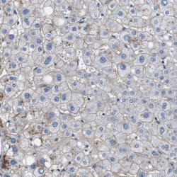 Invitrogen SLC30A1 Polyclonal Antibody 100 &mu;L; Unconjugated:Antibodies,