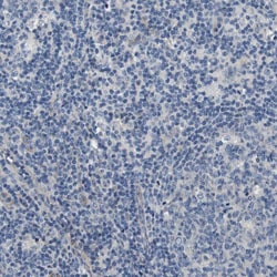 Invitrogen SLC30A1 Polyclonal Antibody 100 &mu;L; Unconjugated:Antibodies,