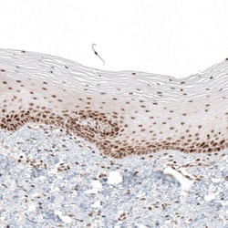 Invitrogen HLTF Polyclonal Antibody 100 &mu;L; Unconjugated:Antibodies,