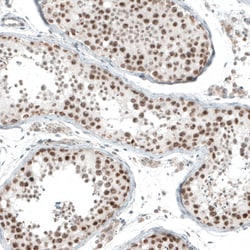 Invitrogen HLTF Polyclonal Antibody 100 &mu;L; Unconjugated:Antibodies,