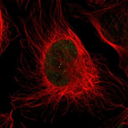Invitrogen MYH11 Polyclonal Antibody 100 &mu;L; Unconjugated:Antibodies,