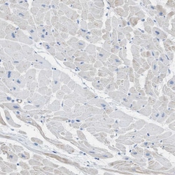 Invitrogen MYH11 Polyclonal Antibody 100 &mu;L; Unconjugated:Antibodies,