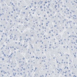 Invitrogen MYH11 Polyclonal Antibody 100 &mu;L; Unconjugated:Antibodies,