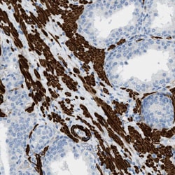 Invitrogen MYH11 Polyclonal Antibody 100 &mu;L; Unconjugated:Antibodies,