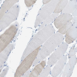 Invitrogen MYH11 Polyclonal Antibody 100 &mu;L; Unconjugated:Antibodies,