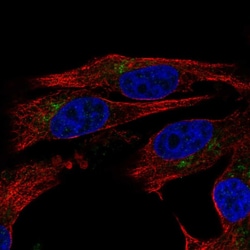 Invitrogen ENTPD6 Polyclonal Antibody 100 &mu;L; Unconjugated:Antibodies,