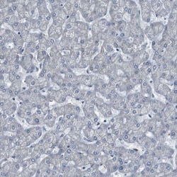 Invitrogen PRAK Polyclonal Antibody 100 &mu;L; Unconjugated:Antibodies,