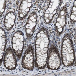 Invitrogen PRAK Polyclonal Antibody 100 &mu;L; Unconjugated:Antibodies,