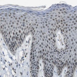 Invitrogen PRAK Polyclonal Antibody 100 &mu;L; Unconjugated:Antibodies,