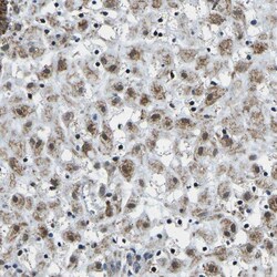Invitrogen BNIP3L Polyclonal Antibody 100 &mu;L; Unconjugated:Antibodies,