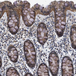 Invitrogen PERK Polyclonal Antibody 100 &mu;L; Unconjugated:Antibodies,