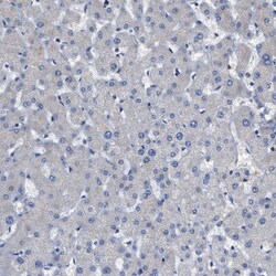 Invitrogen PERK Polyclonal Antibody 100 &mu;L; Unconjugated:Antibodies,
