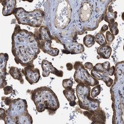 Invitrogen PERK Polyclonal Antibody 100 &mu;L; Unconjugated:Antibodies,