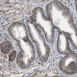 Invitrogen PERK Polyclonal Antibody 100 &mu;L; Unconjugated:Antibodies,