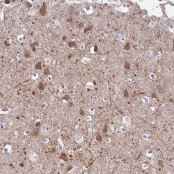 Invitrogen DCAMKL2 Polyclonal Antibody 100 &mu;L; Unconjugated:Antibodies,