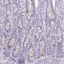 Invitrogen DCAMKL2 Polyclonal Antibody 100 &mu;L | Buy Online | Invitrogen&trade; | Fisher Scientific